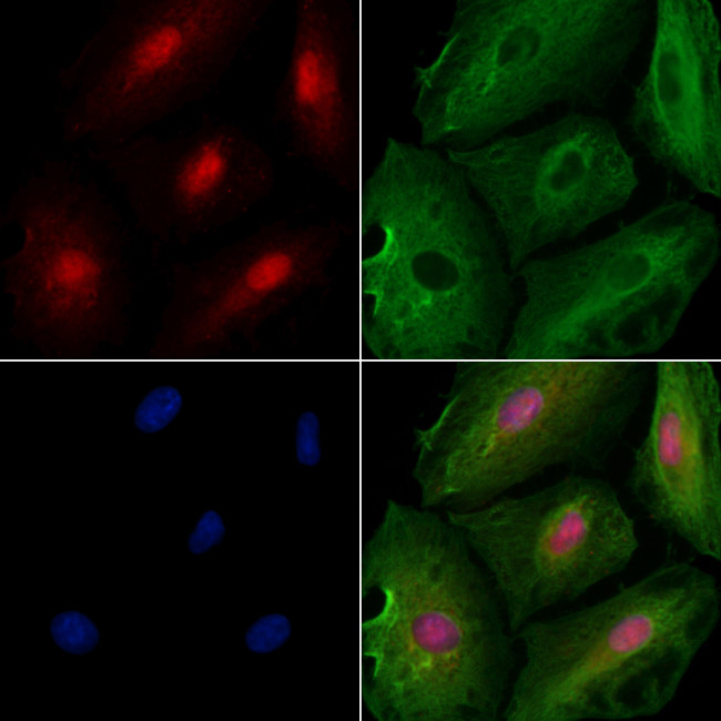 GADD45B Antibody in Immunocytochemistry (ICC/IF)