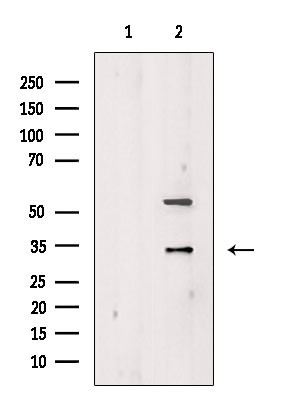 Granzyme K Antibody in Western Blot (WB)