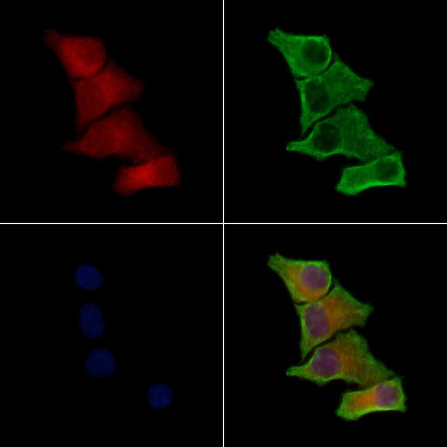 Laminin beta-3 Antibody in Immunocytochemistry (ICC/IF)