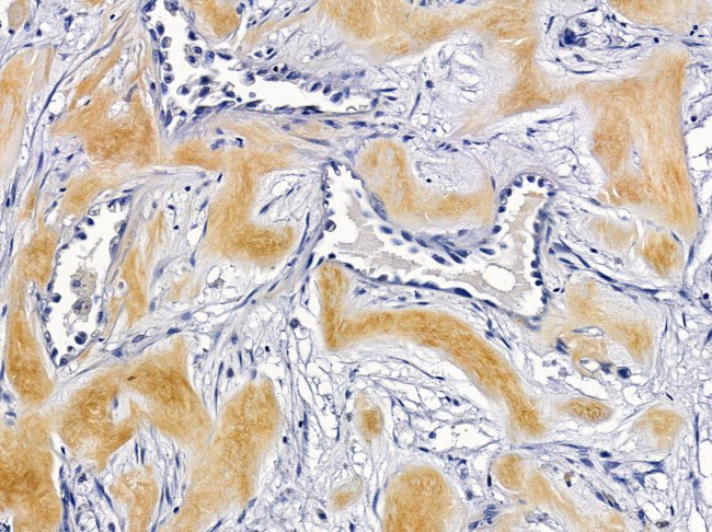 Laminin beta-3 Antibody in Immunohistochemistry (Paraffin) (IHC (P))