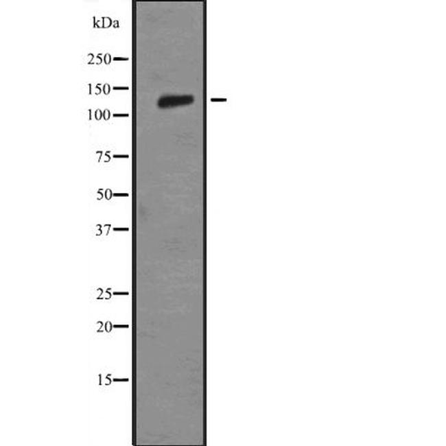 Laminin beta-3 Antibody in Western Blot (WB)