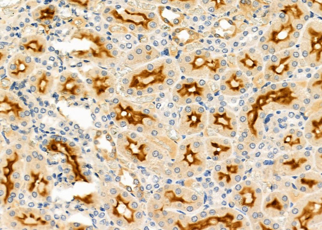 Galectin 10 Antibody in Immunohistochemistry (Paraffin) (IHC (P))