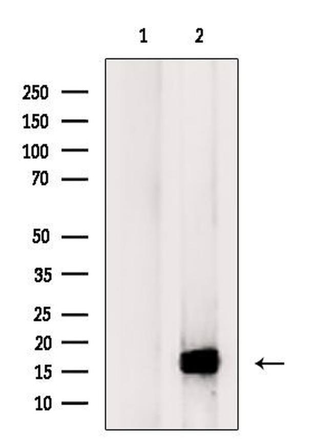 Galectin 10 Antibody in Western Blot (WB)