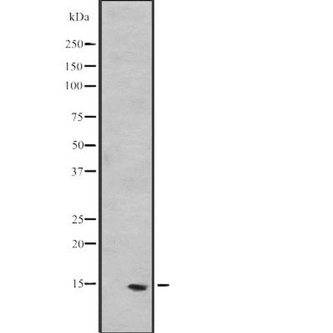 PEA15 Antibody in Western Blot (WB)