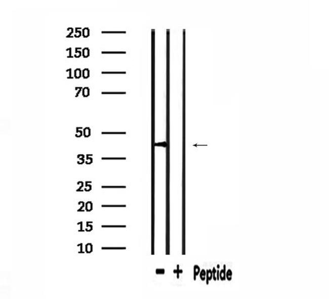 PHLDA1 Antibody in Western Blot (WB)