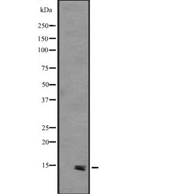 PHLDA3 Antibody in Western Blot (WB)