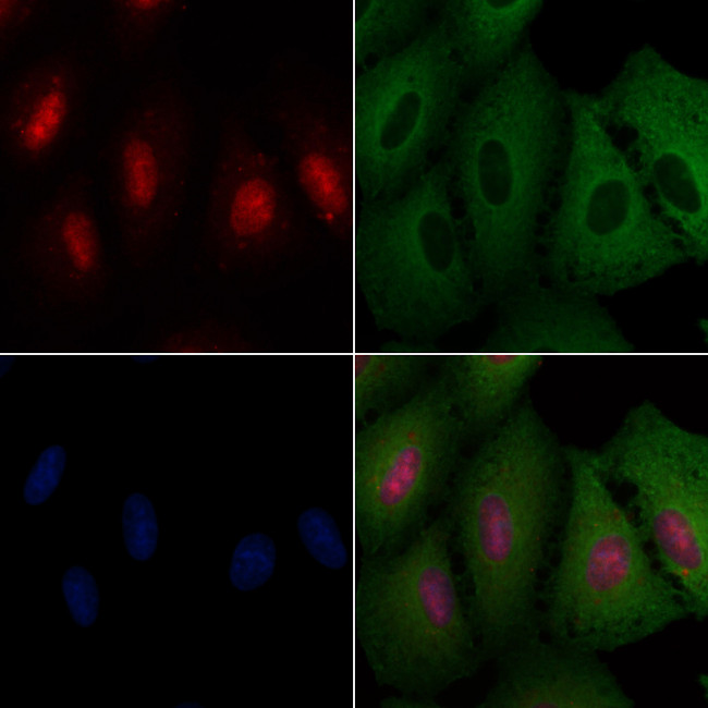 ZNF750 Antibody in Immunocytochemistry (ICC/IF)