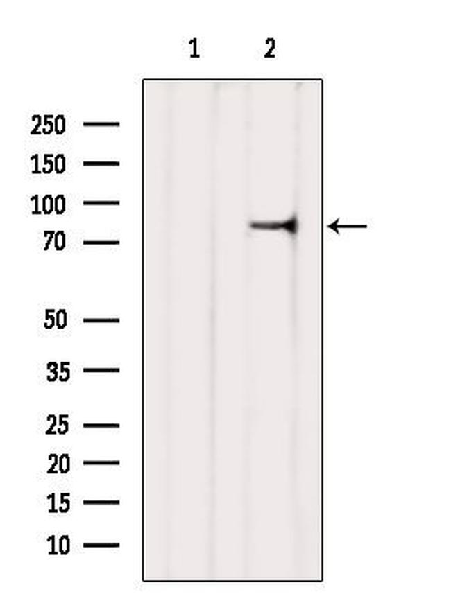 ZNF750 Antibody in Western Blot (WB)