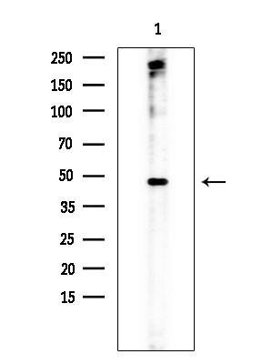 JMJD2D Antibody in Western Blot (WB)