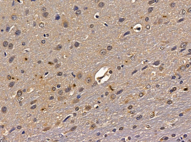 ZSCAN2 Antibody in Immunohistochemistry (Paraffin) (IHC (P))