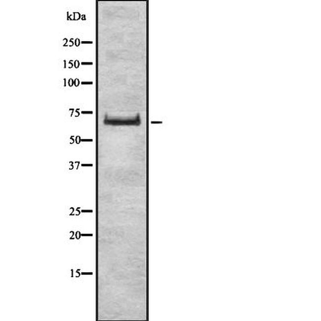 ZSCAN2 Antibody in Western Blot (WB)