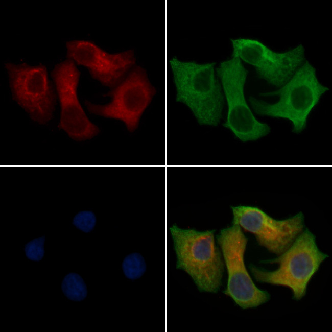 XRN1 Antibody in Immunocytochemistry (ICC/IF)