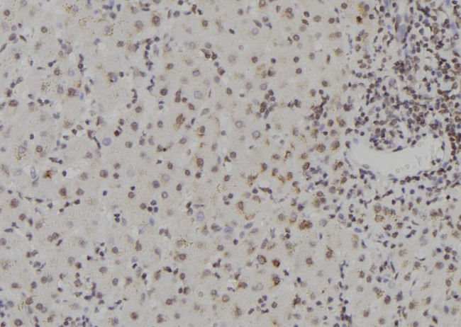 ZNF709 Antibody in Immunohistochemistry (Paraffin) (IHC (P))