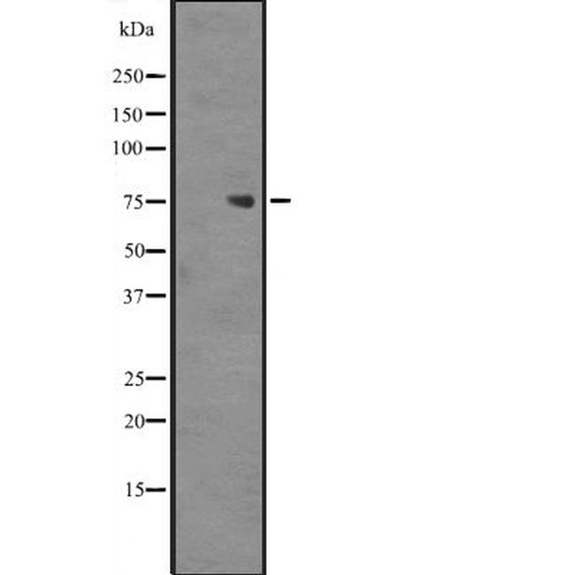 ZNF709 Antibody in Western Blot (WB)