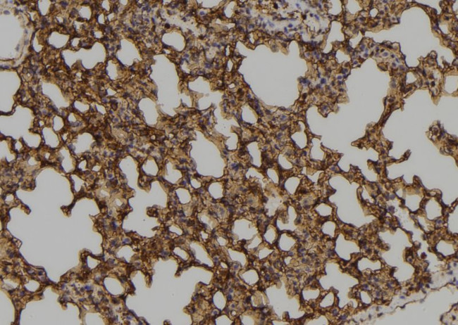 ZNF768 Antibody in Immunohistochemistry (Paraffin) (IHC (P))