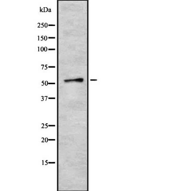 ZNF768 Antibody in Western Blot (WB)