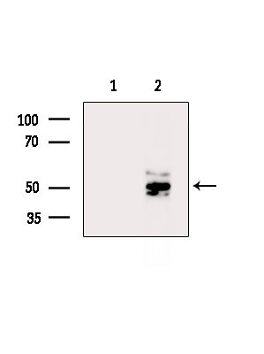 DMRTB1 Antibody in Western Blot (WB)