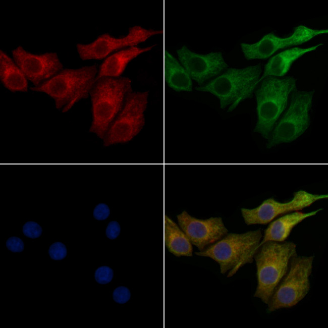 TCHP Antibody in Immunocytochemistry (ICC/IF)