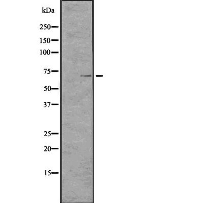 TCHP Antibody in Western Blot (WB)