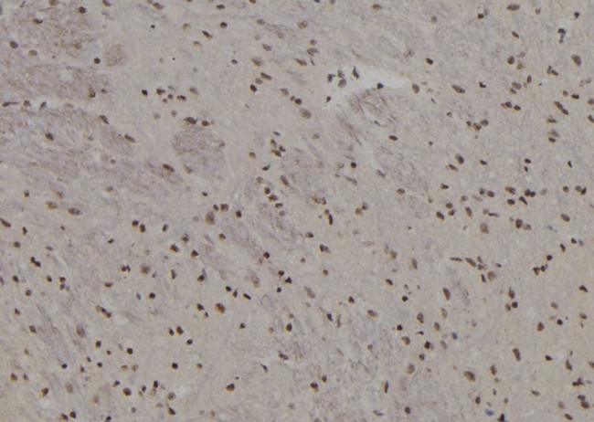 BACH2 Antibody in Immunohistochemistry (Paraffin) (IHC (P))