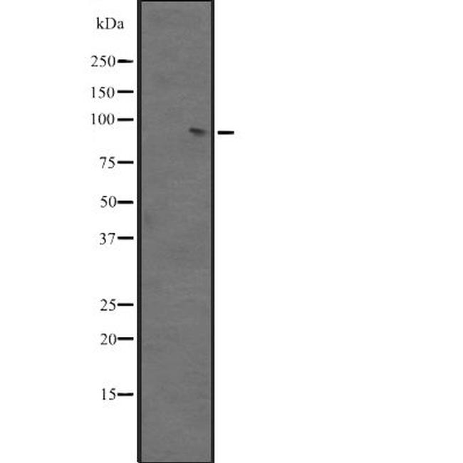 BACH2 Antibody in Western Blot (WB)