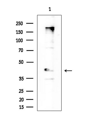 BACH2 Antibody in Western Blot (WB)