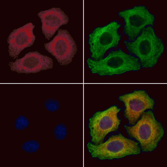 TRIM31 Antibody in Immunocytochemistry (ICC/IF)