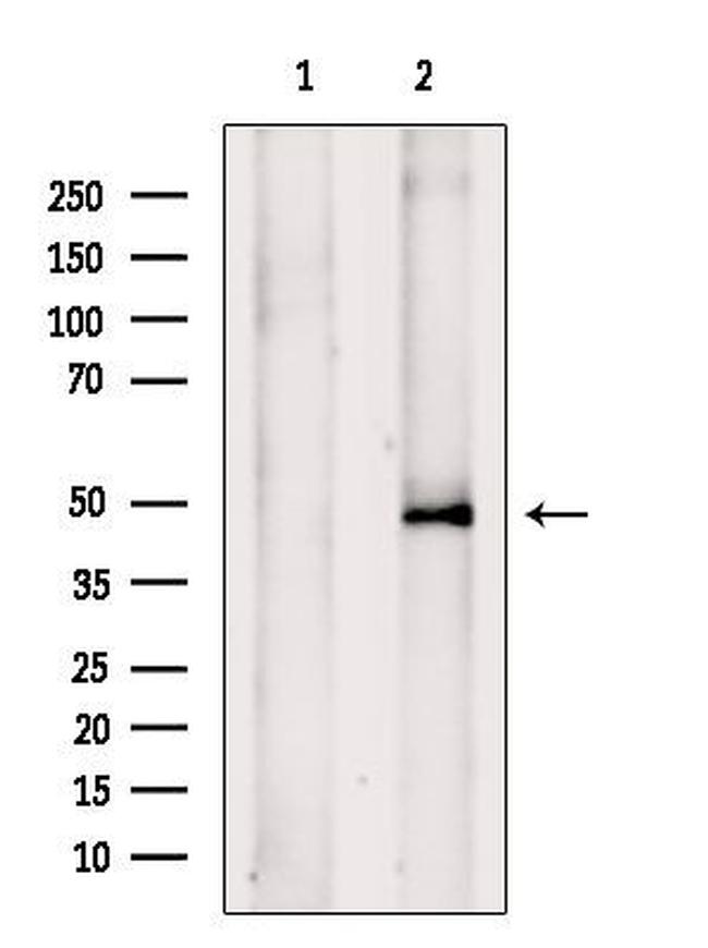 TRIM31 Antibody in Western Blot (WB)