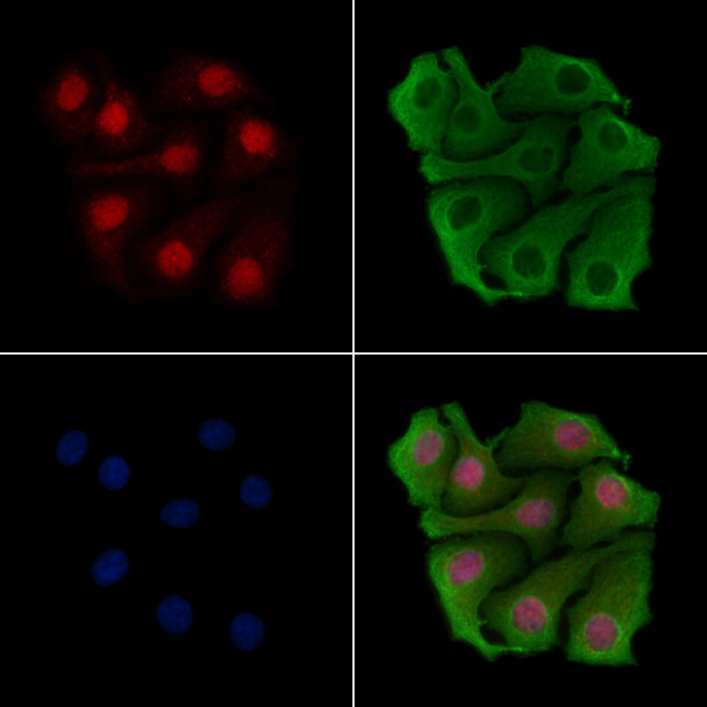 BCL11B Antibody in Immunocytochemistry (ICC/IF)