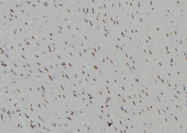 BCL11B Antibody in Immunohistochemistry (Paraffin) (IHC (P))