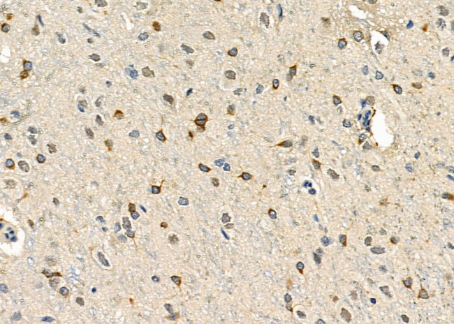 TSPYL2 Antibody in Immunohistochemistry (Paraffin) (IHC (P))