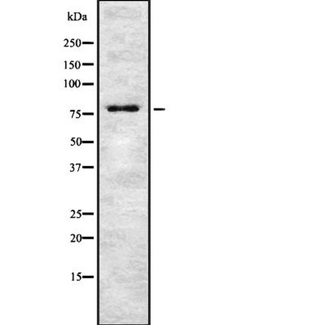 TSPYL2 Antibody in Western Blot (WB)