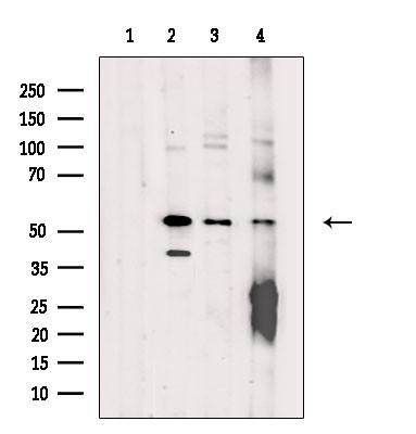 ZNF71 Antibody in Western Blot (WB)