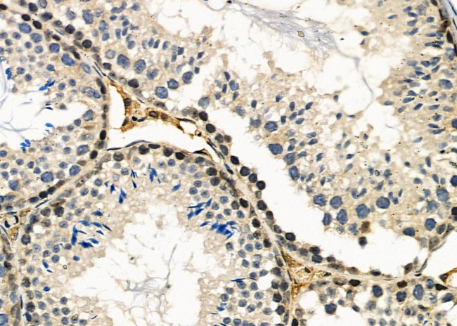 TOPORS Antibody in Immunohistochemistry (Paraffin) (IHC (P))