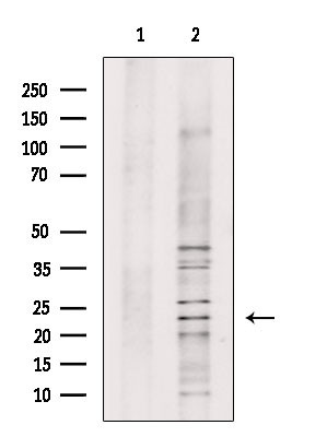 WARS2 Antibody in Western Blot (WB)