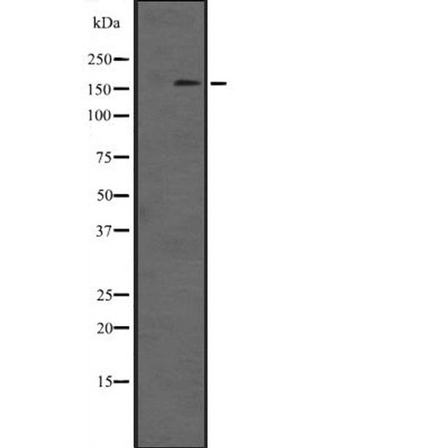 DOT1L Antibody in Western Blot (WB)