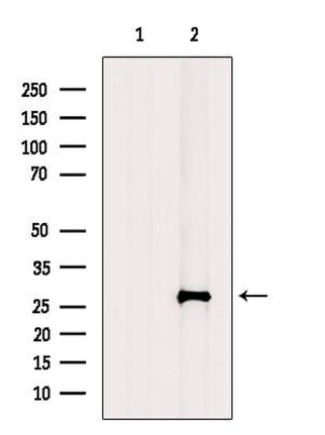 FGF12 Antibody in Western Blot (WB)