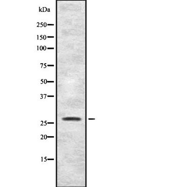 FGFBP1 Antibody in Western Blot (WB)