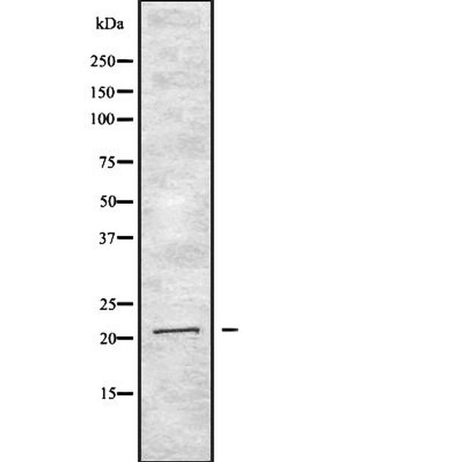 Interferon alpha-2 Antibody in Western Blot (WB)