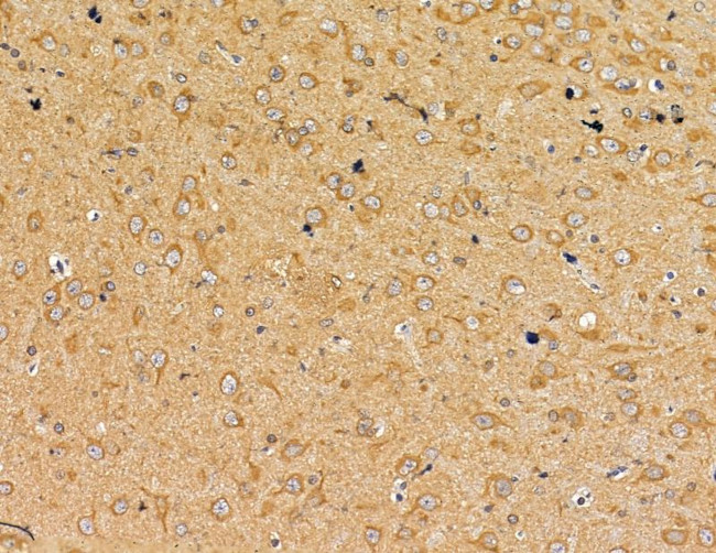 Interferon alpha-4/10/14 Antibody in Immunohistochemistry (Paraffin) (IHC (P))