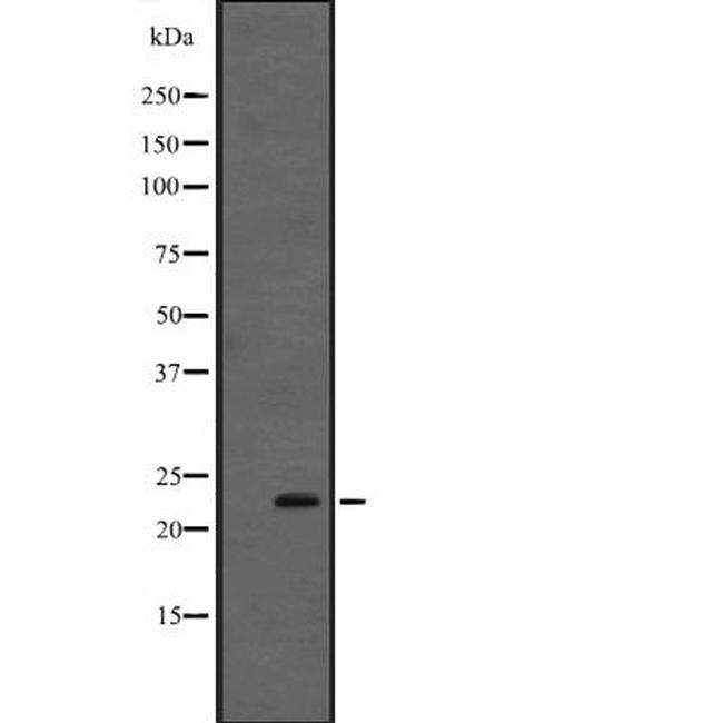 Interferon alpha-4/10/14 Antibody in Western Blot (WB)