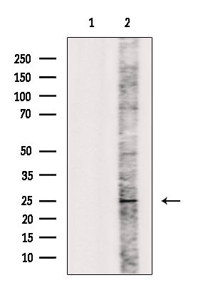 IL1F6 Antibody in Western Blot (WB)