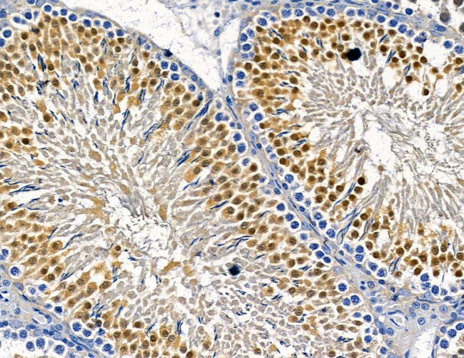 IFI35 Antibody in Immunohistochemistry (Paraffin) (IHC (P))