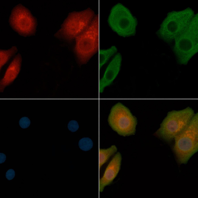 CD49a Antibody in Immunocytochemistry (ICC/IF)