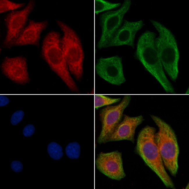 CD49a Antibody in Immunocytochemistry (ICC/IF)