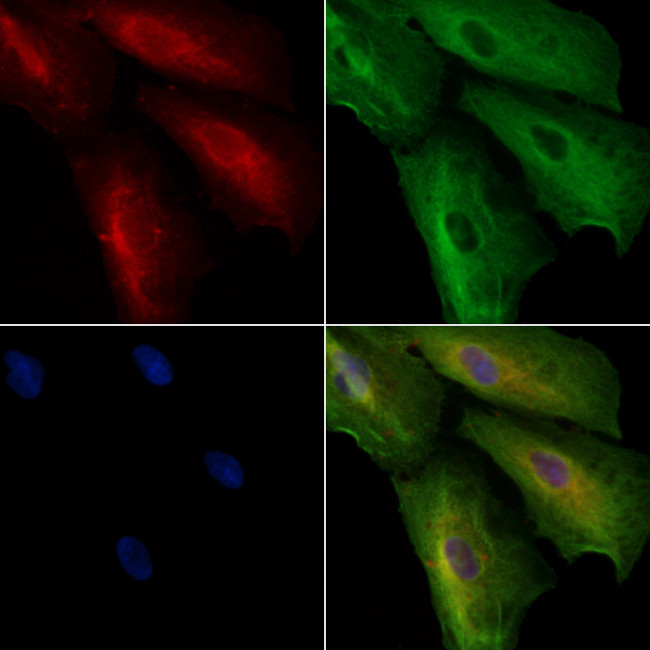 Integrin beta 7 Antibody in Immunocytochemistry (ICC/IF)