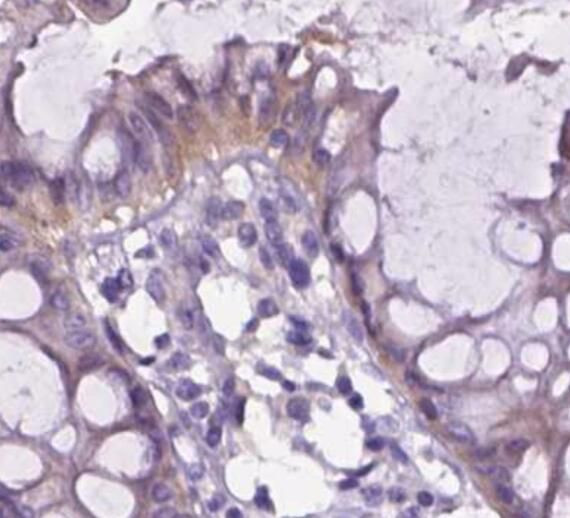 Integrin beta 7 Antibody in Immunohistochemistry (Paraffin) (IHC (P))