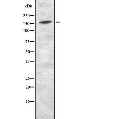 KDM5D Antibody in Western Blot (WB)