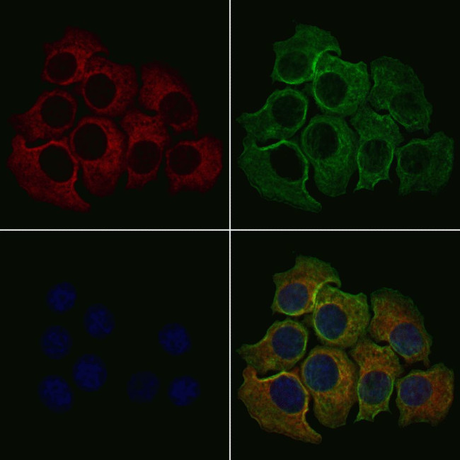 PLCE1 Antibody in Immunocytochemistry (ICC/IF)