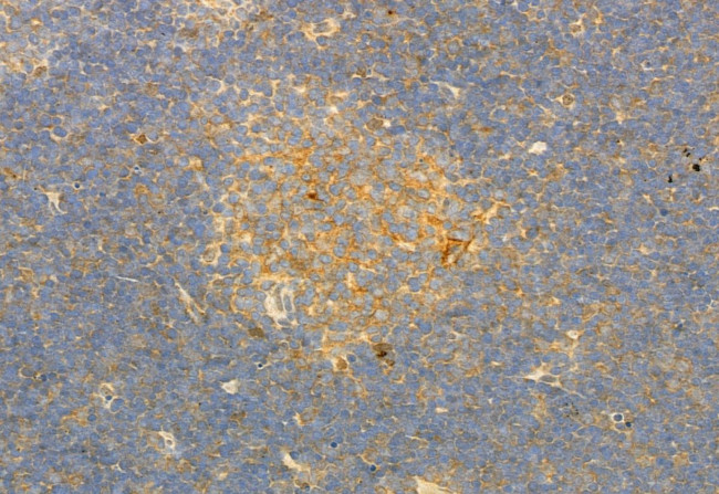 PLCE1 Antibody in Immunohistochemistry (Paraffin) (IHC (P))